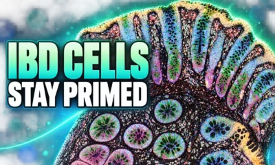 IBD gut cells stay primed after symptoms fade